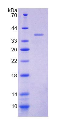 SDS-PAGE